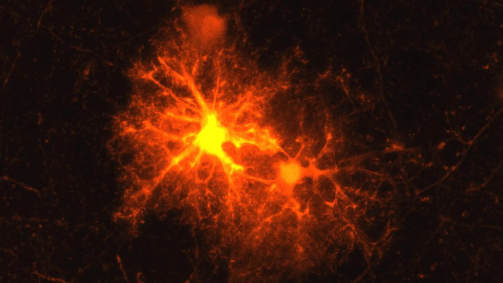 Stress Hormone Helps Repair the Brain