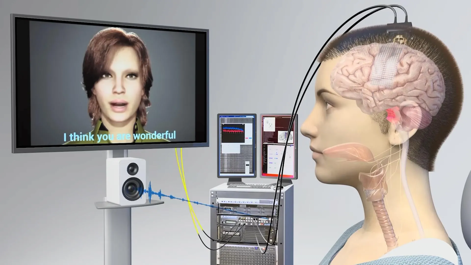 How AI Gave a Paralyzed Woman Her Voice Back