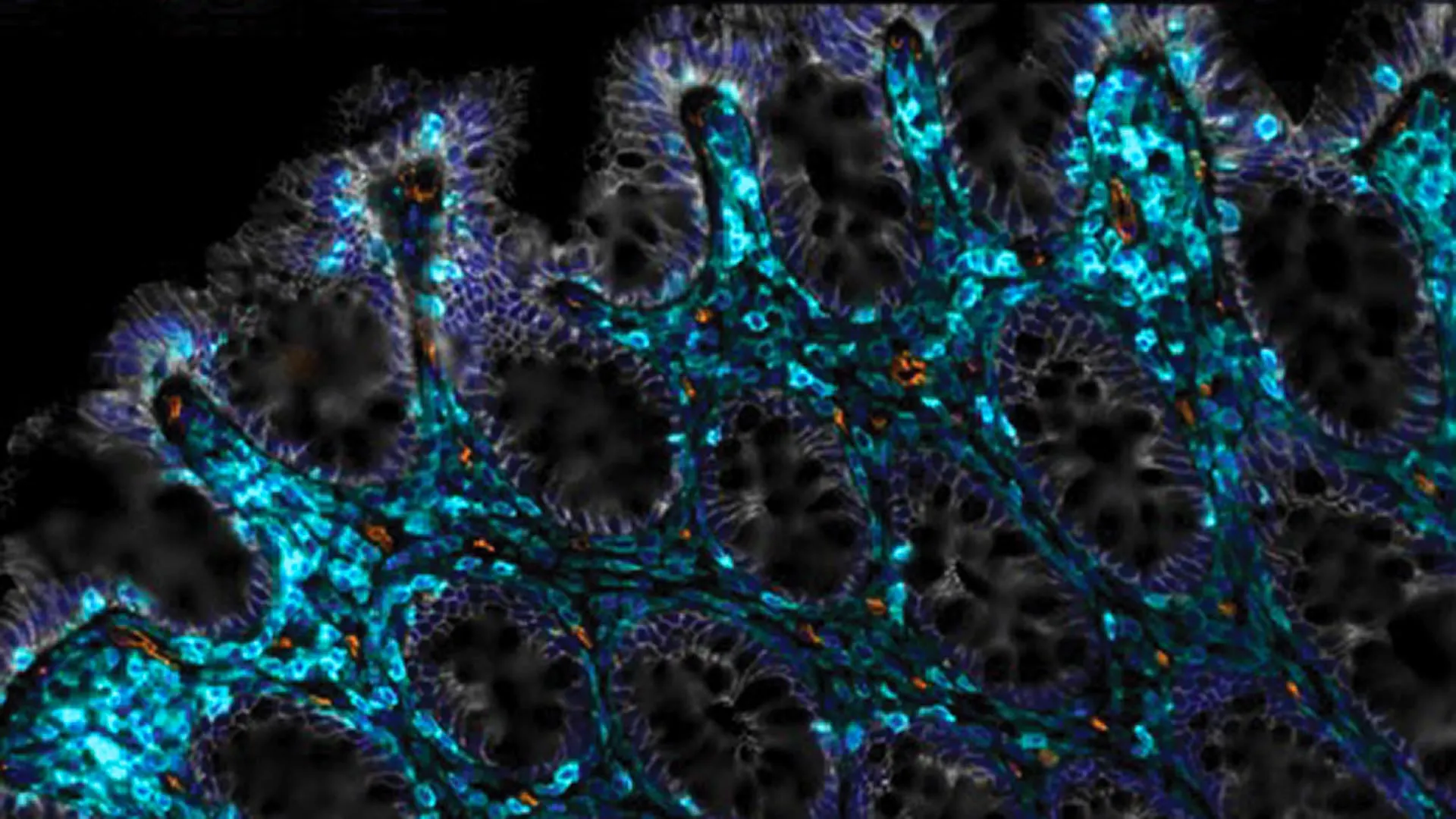 Helping Aging Guts Heal Themselves