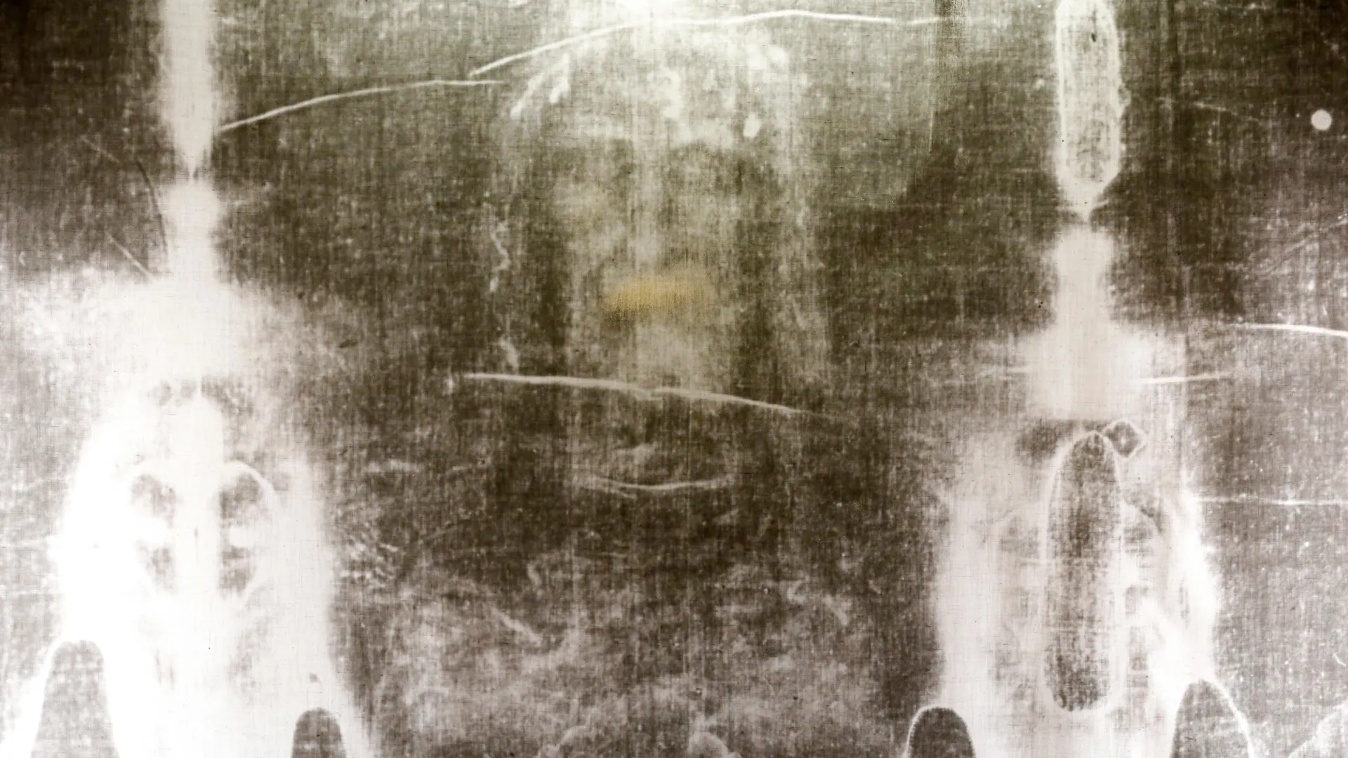 Hidden DNA on the Shroud of Turin