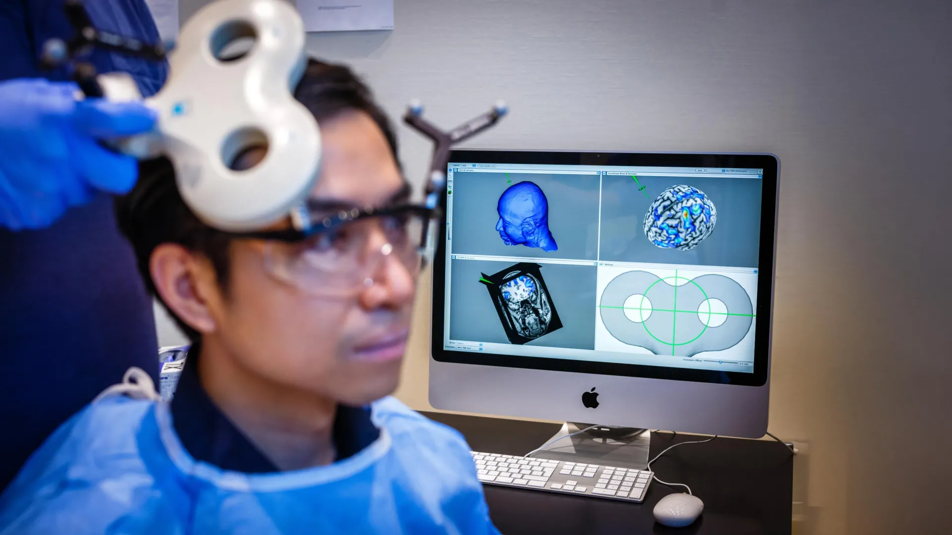 Brain Stimulation Made People More Generous
