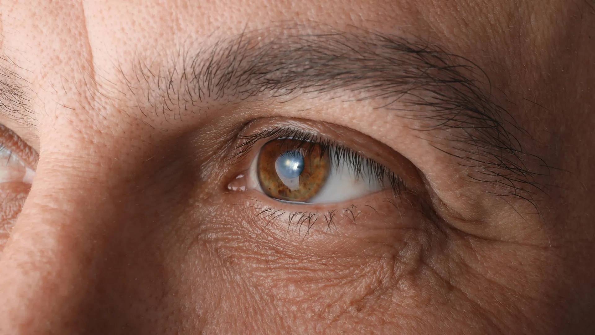Cialis Linked to Higher Glaucoma Risk