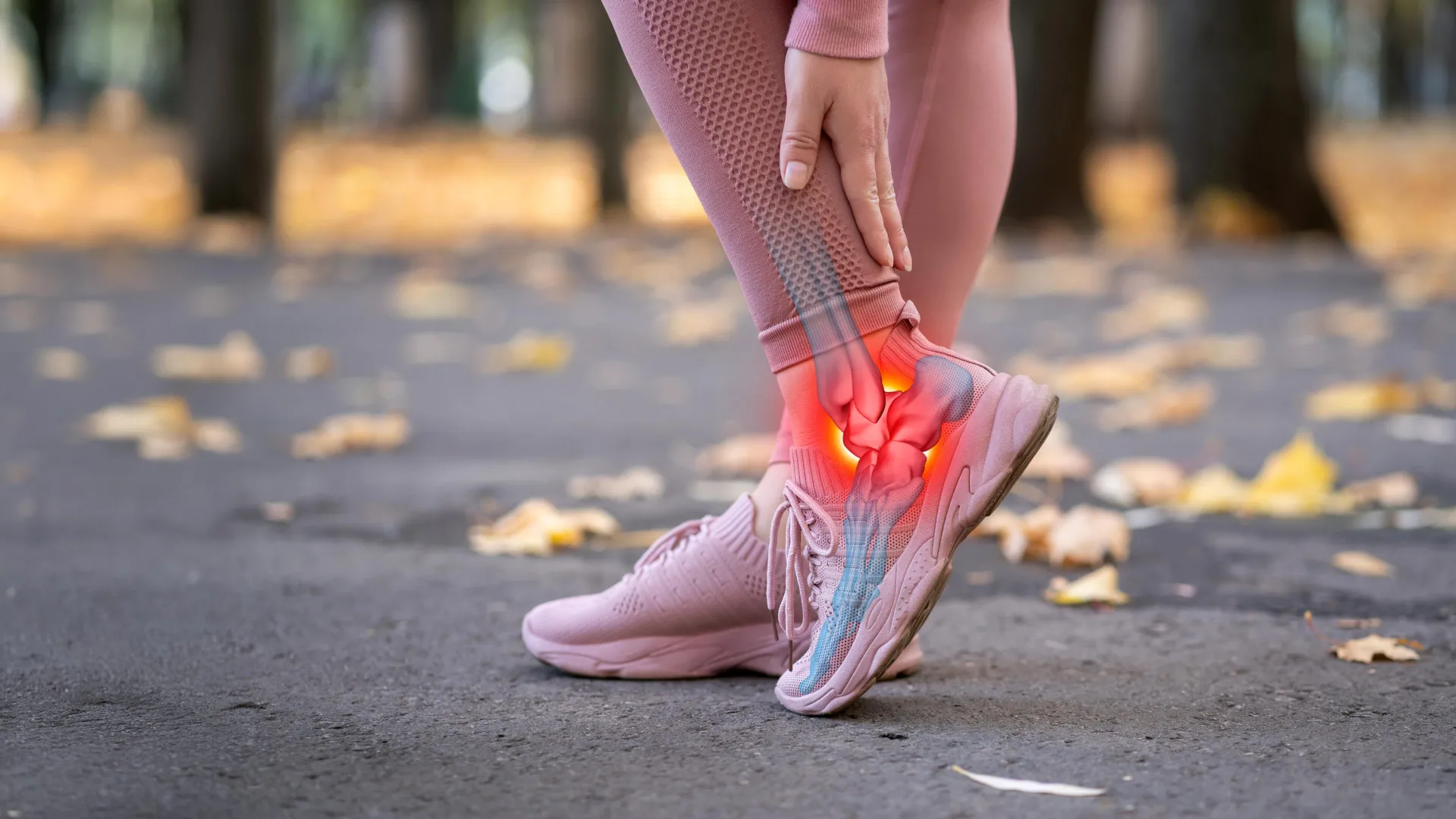 Hidden Trigger of Achilles Pain