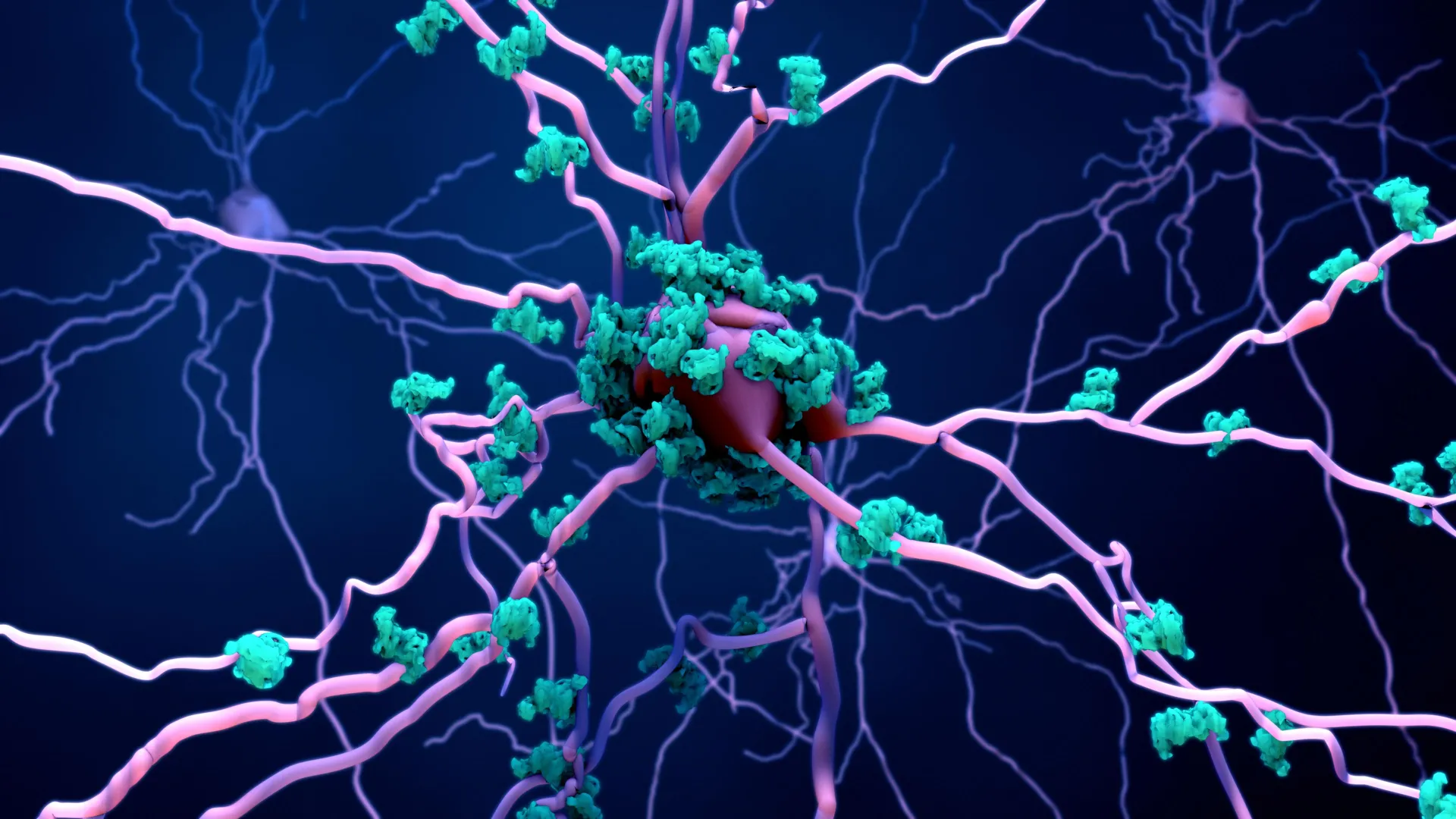 Scientists Discover a Hidden Brain Cell Killer