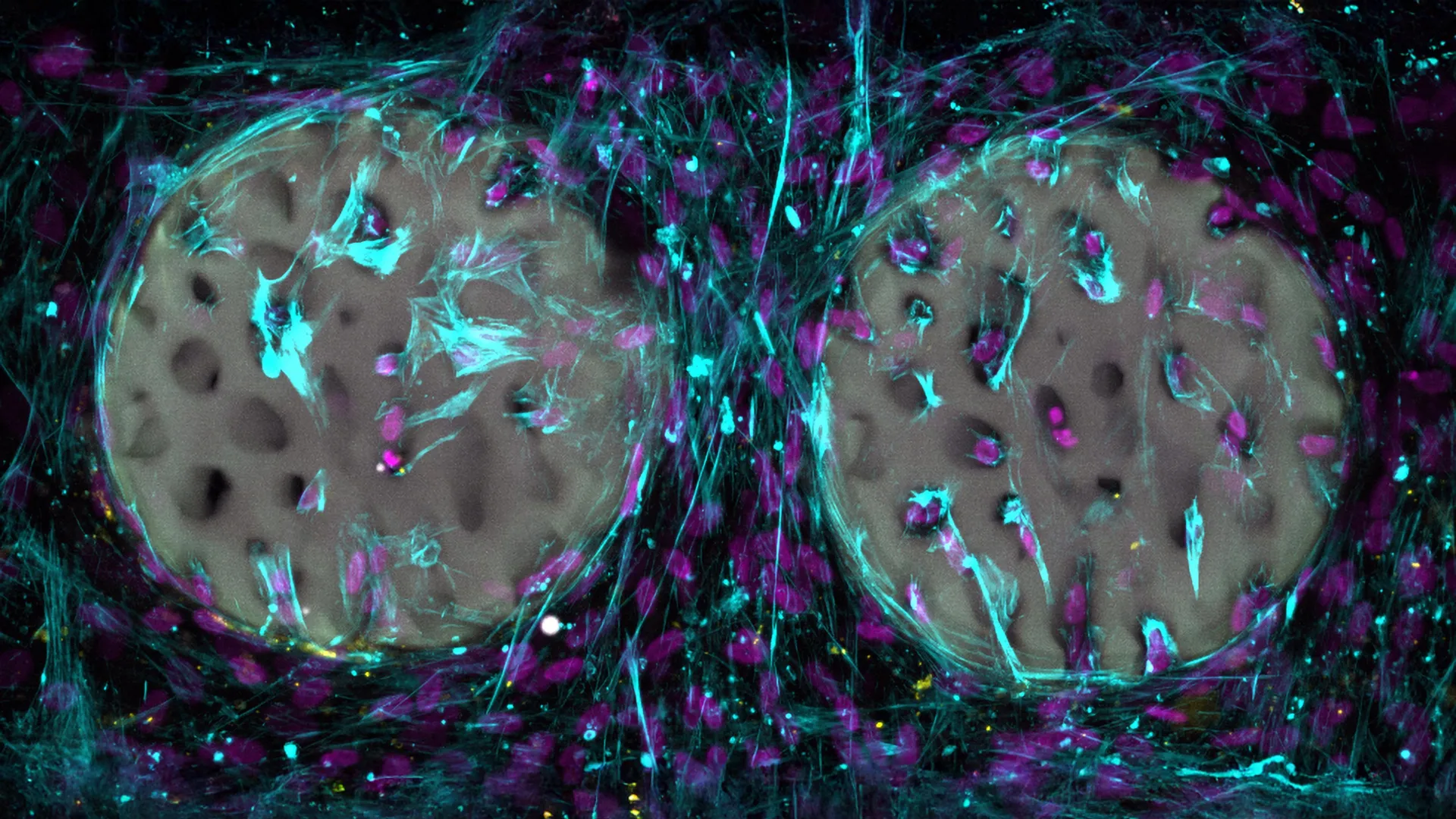 Jelly Implant Helps Bones Heal