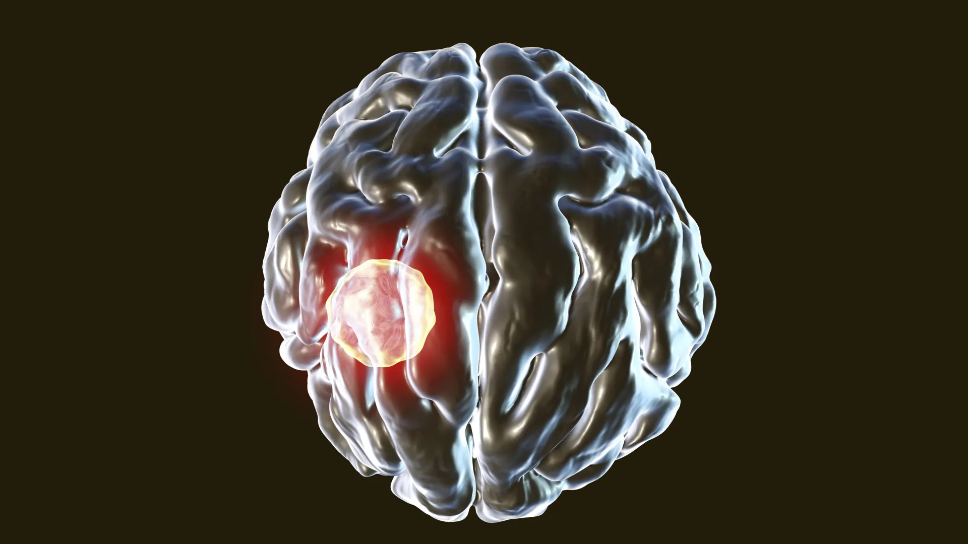 1 in 3 People Carry This Brain Parasite