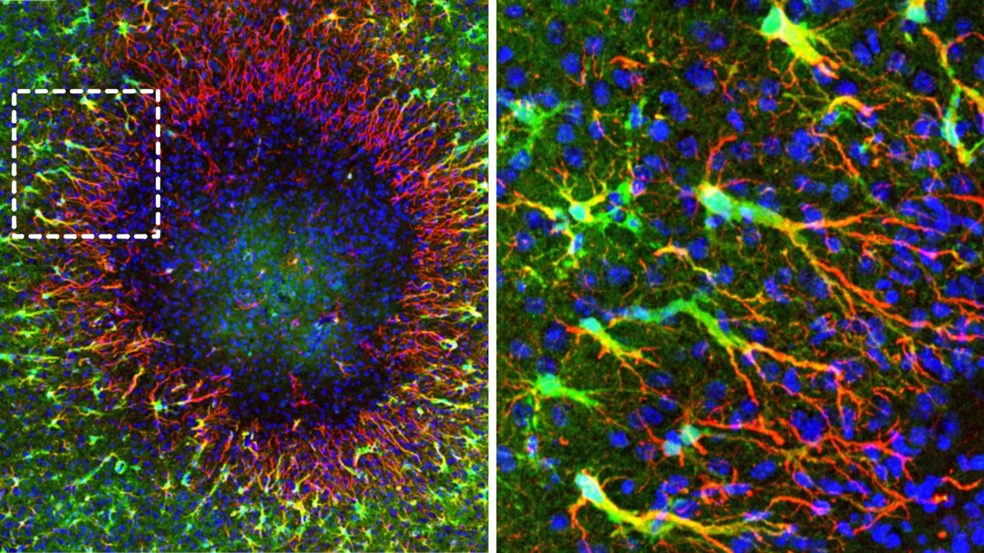 The Brain’s Hidden Repair Power