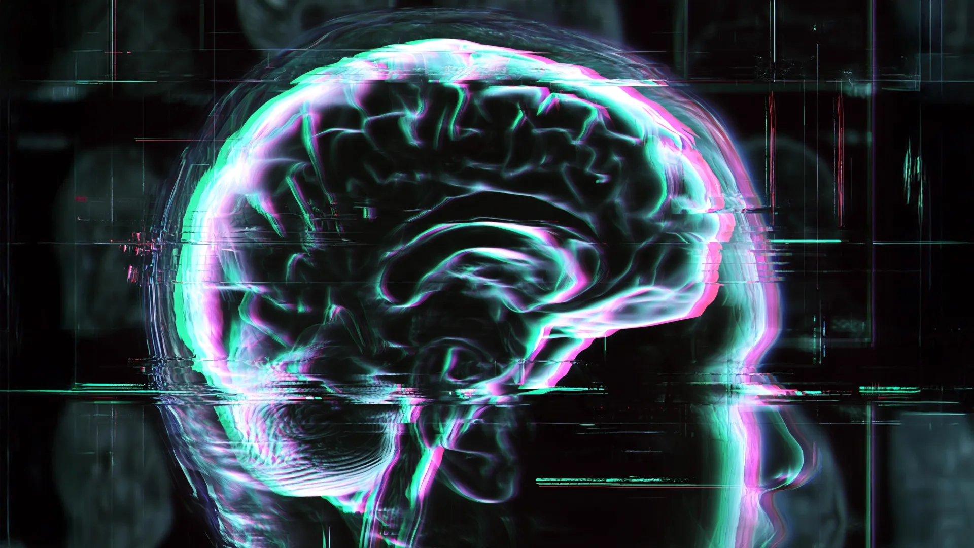 Brain Aging Differs Across Disorders