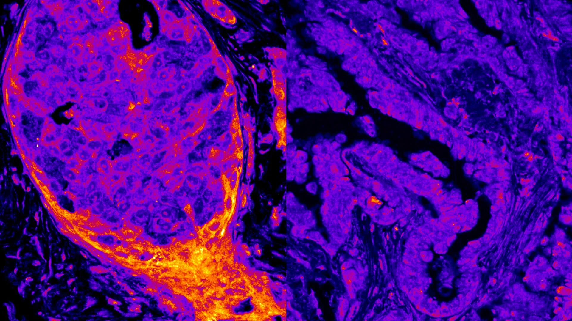 Hidden Metabolism Inside the Cell Nucleus