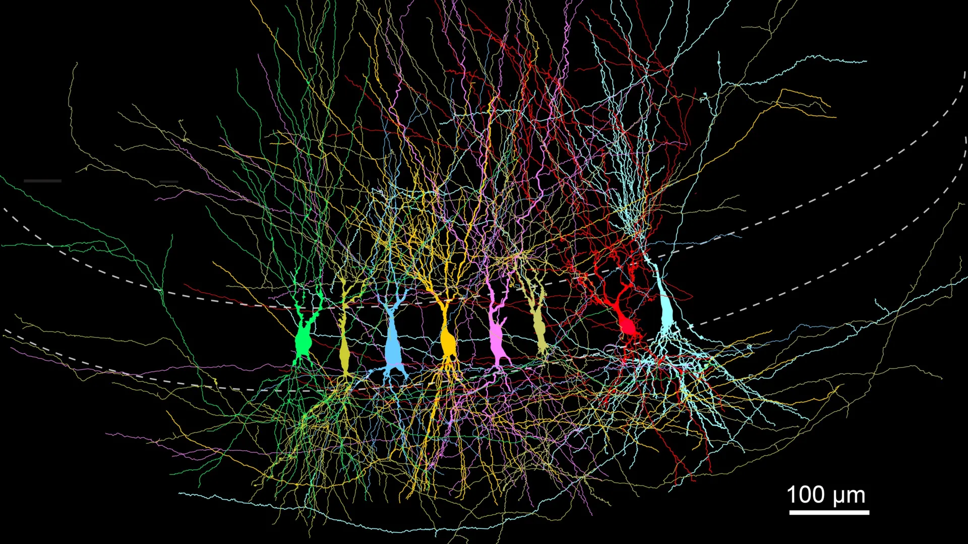 Brain Starts Full Then Refines Memory
