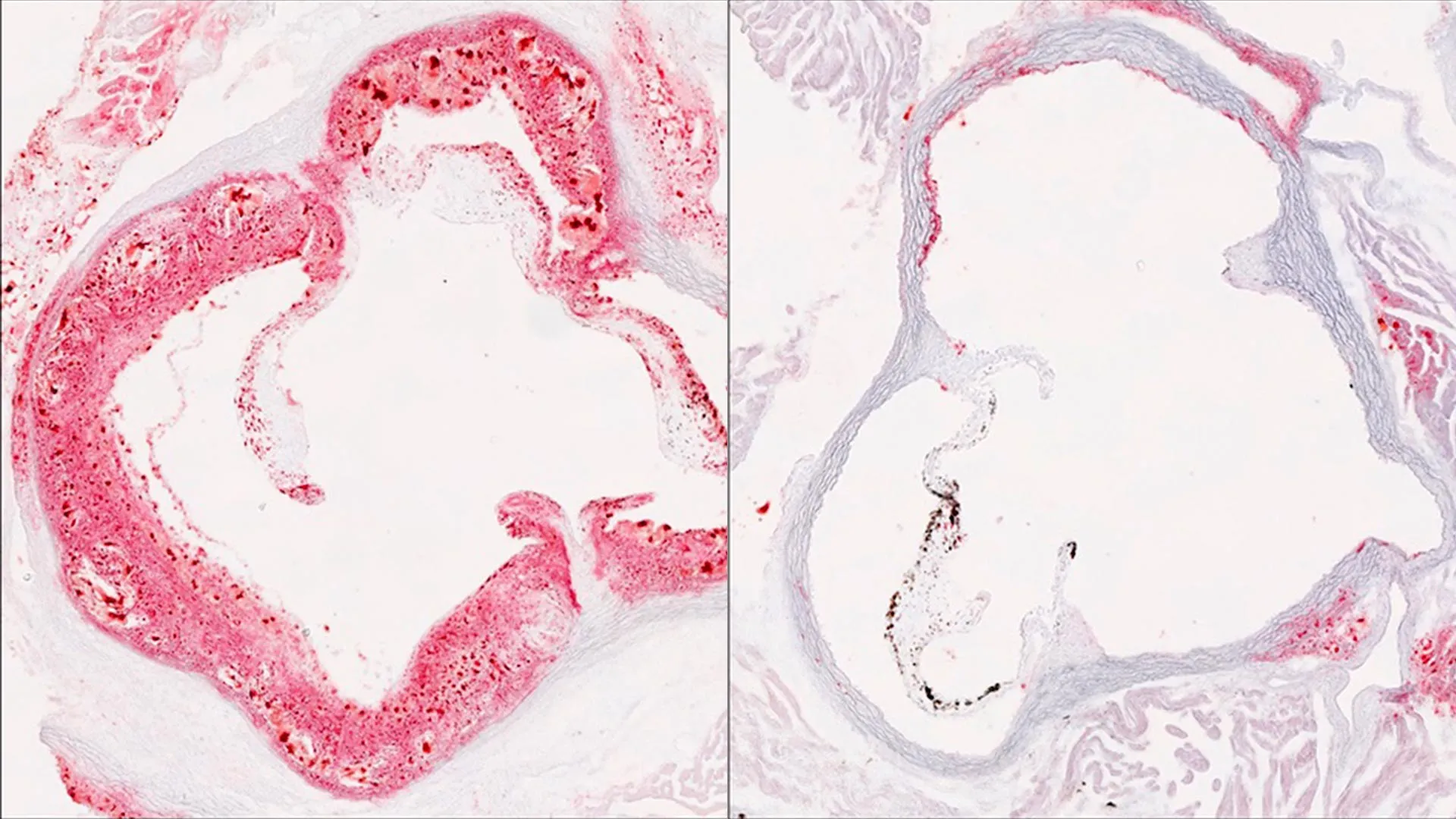 New Cholesterol “Master Switch”