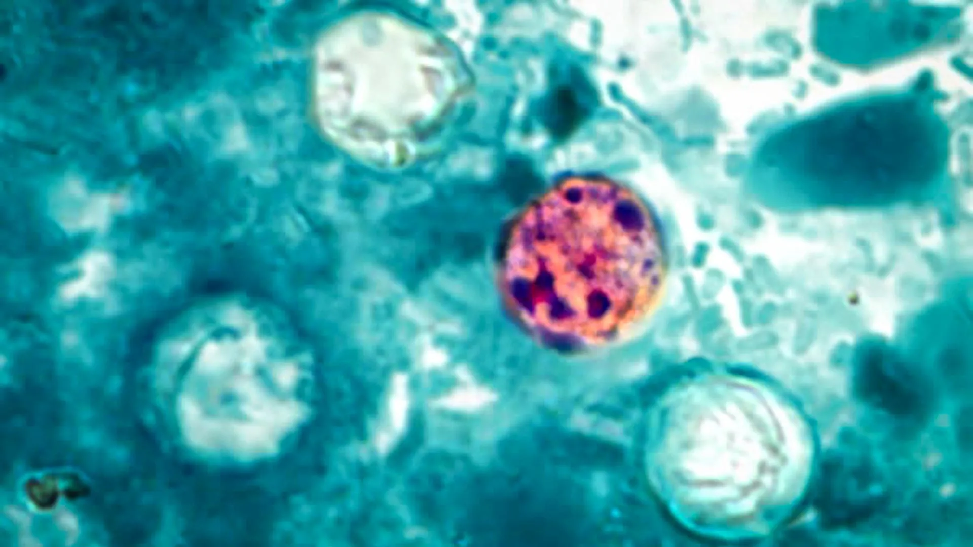 Mystery Outbreak Sickens Hundreds