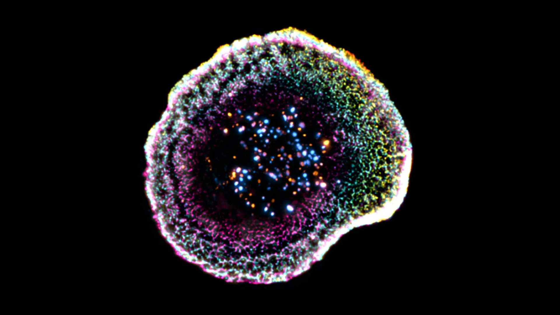 How Killer T Cells Destroy Cancer