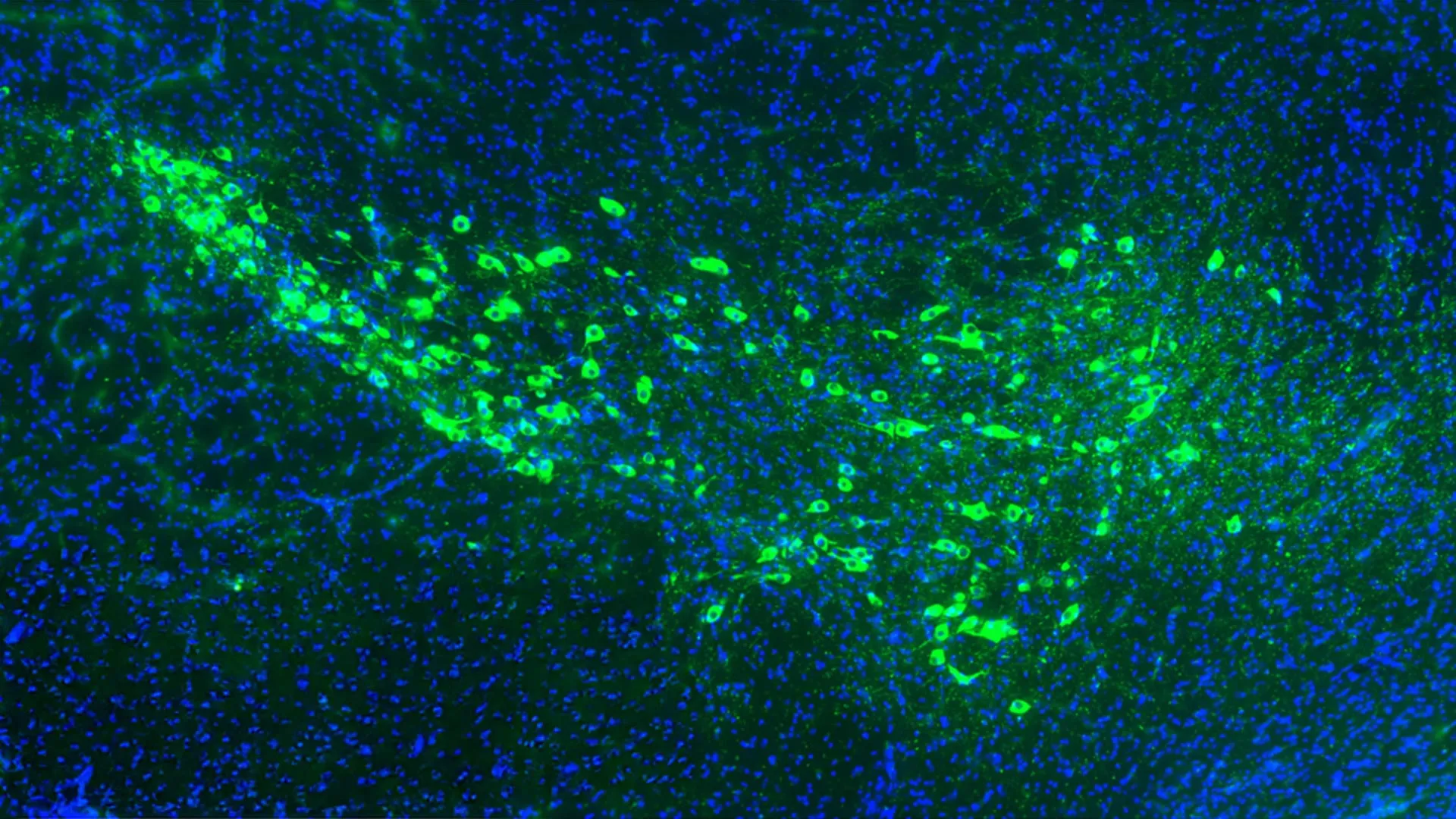 How Parkinson's Disease May Spread