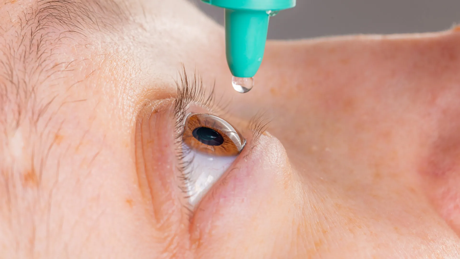 Eye Ointments Linked to Glaucoma Implant Damage