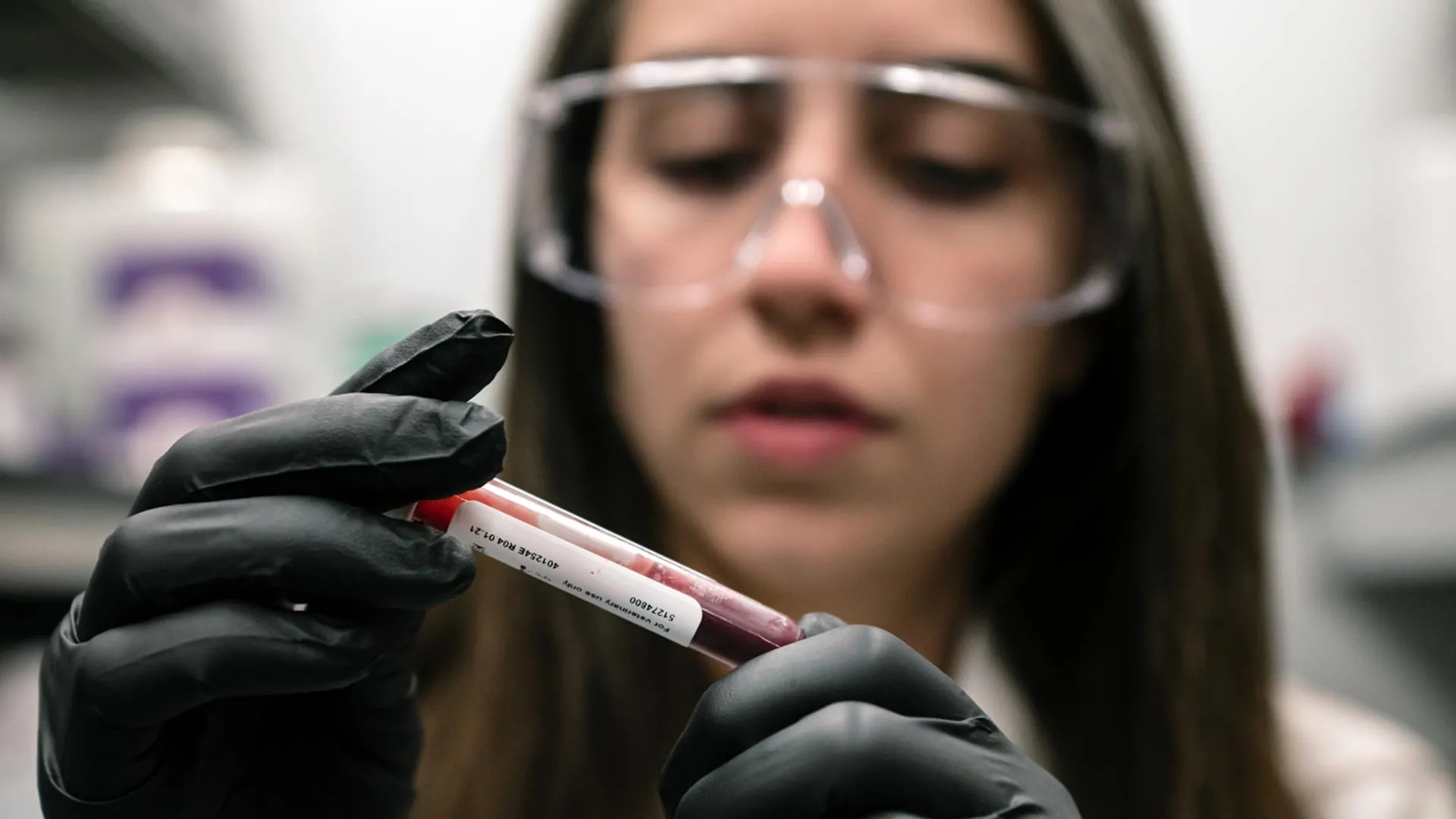 Why High Altitude Protects Against Diabetes