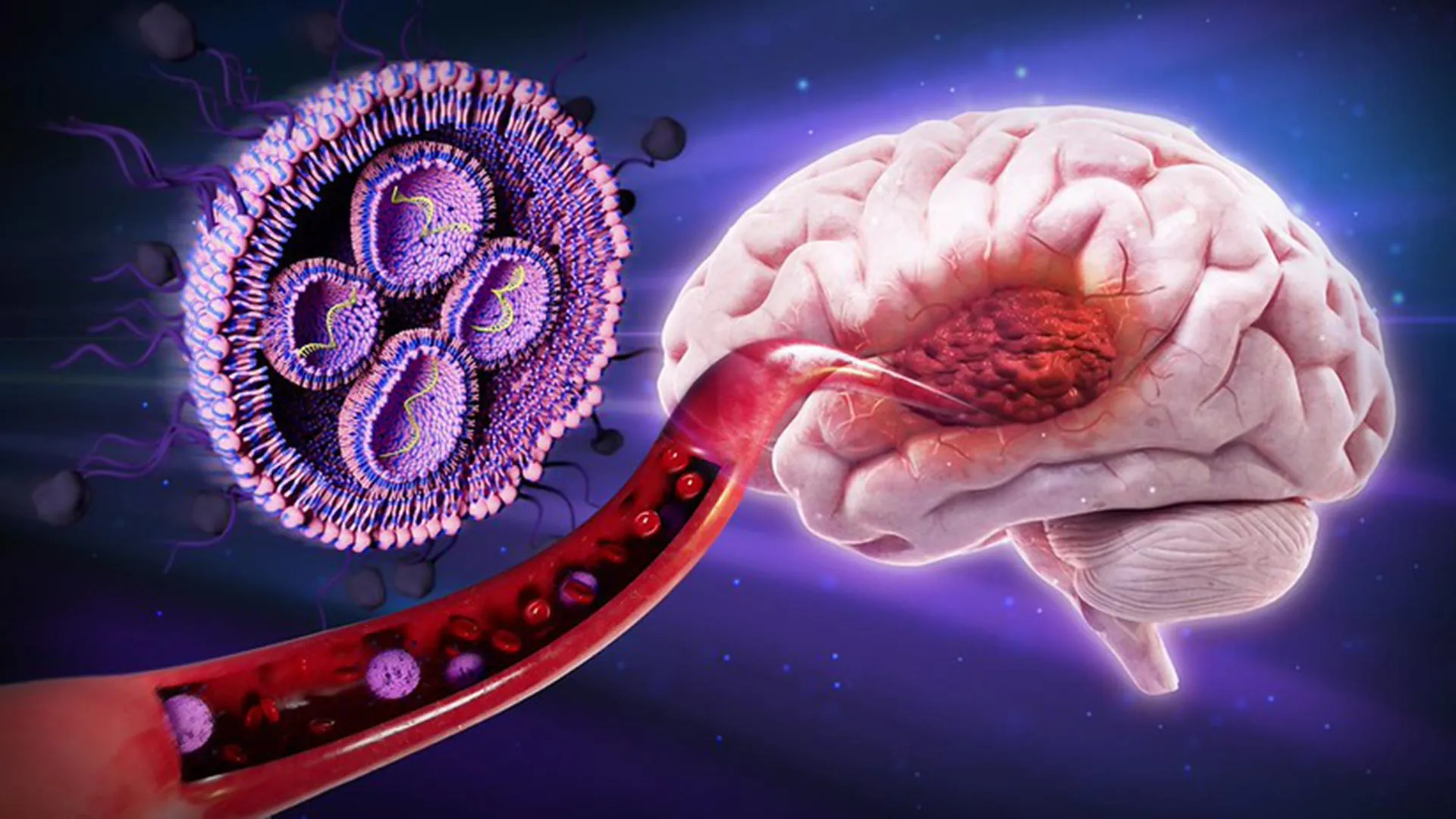 Sugar Outsmarts Brain Cancer