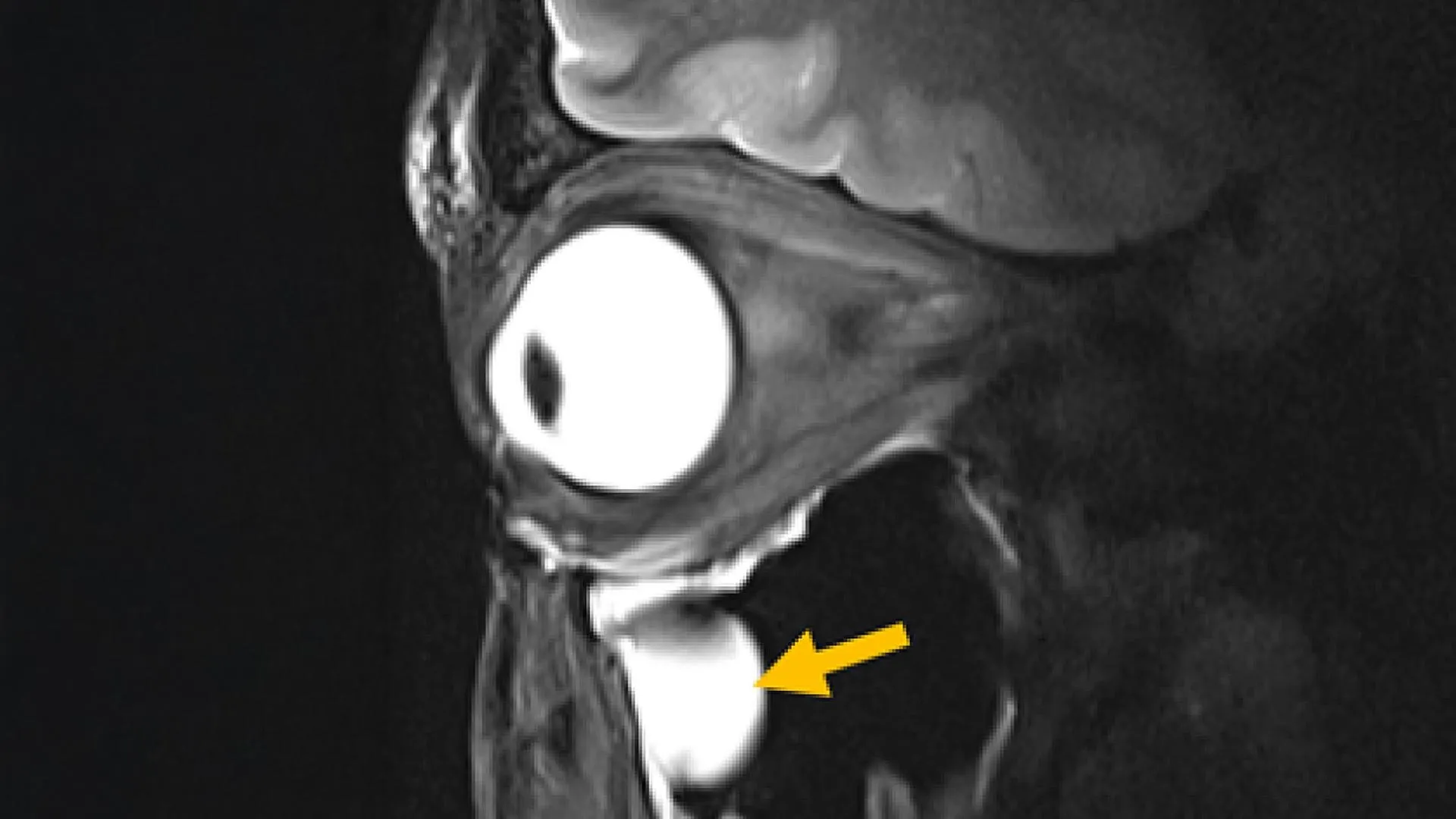 MRI Just Got a Major Upgrade