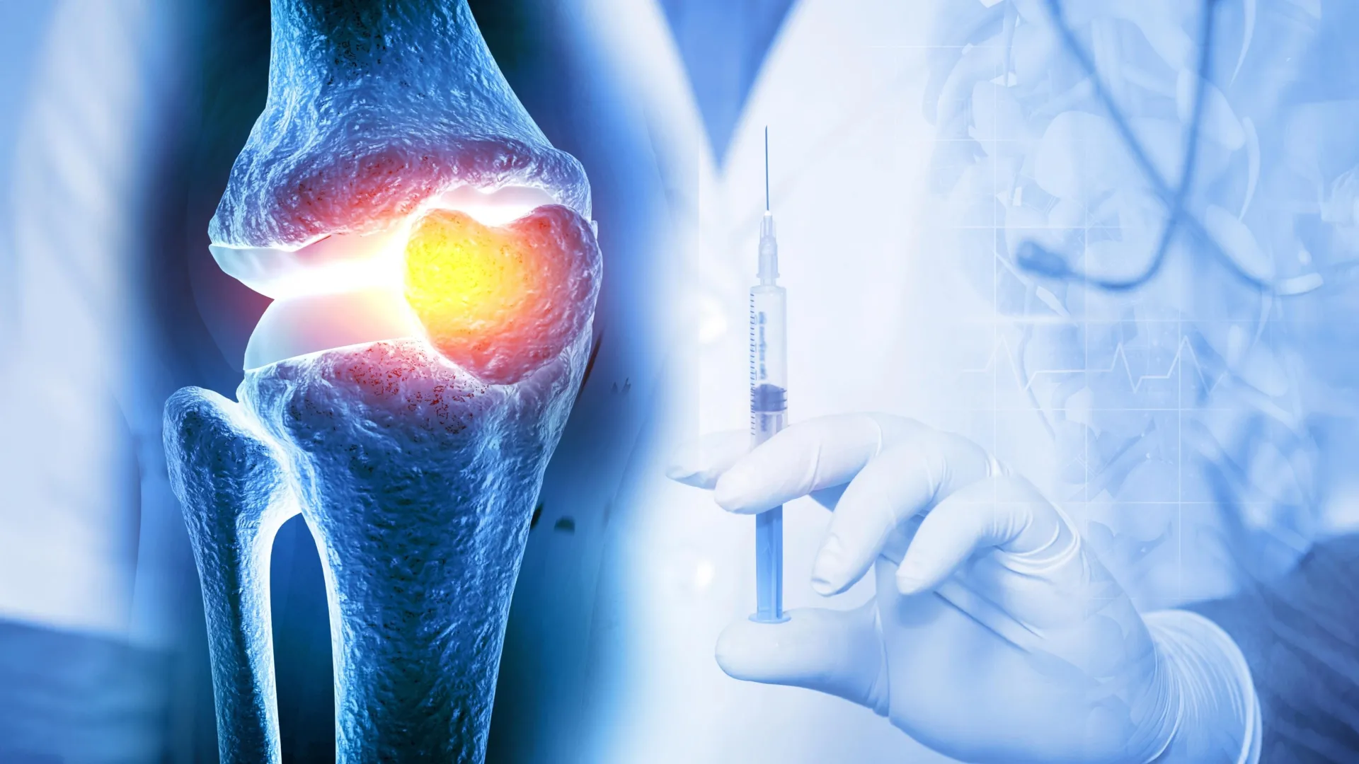 Injection Reversed Osteoarthritis in Weeks