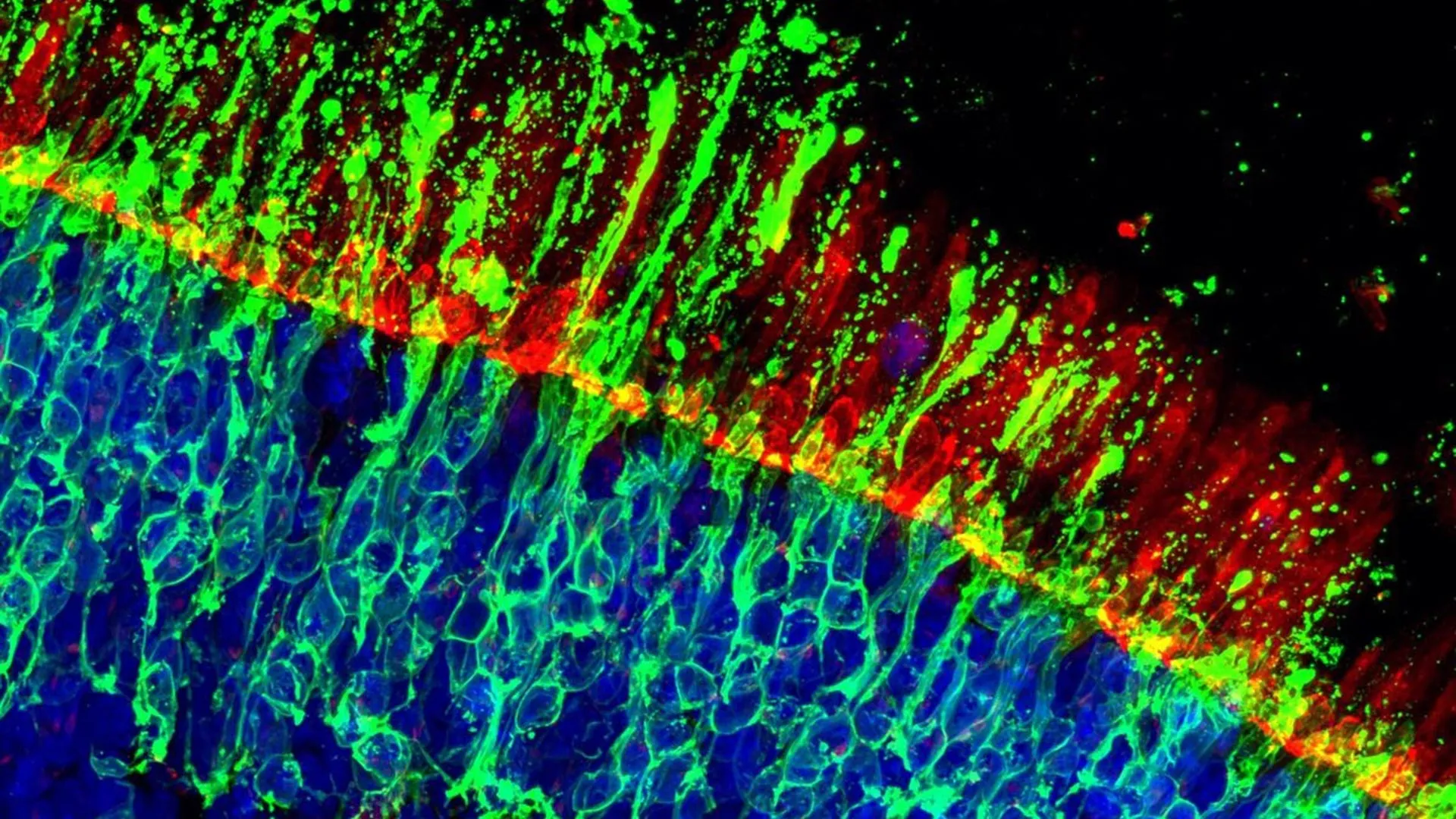 Scientists Find Way to Save Vision Cells
