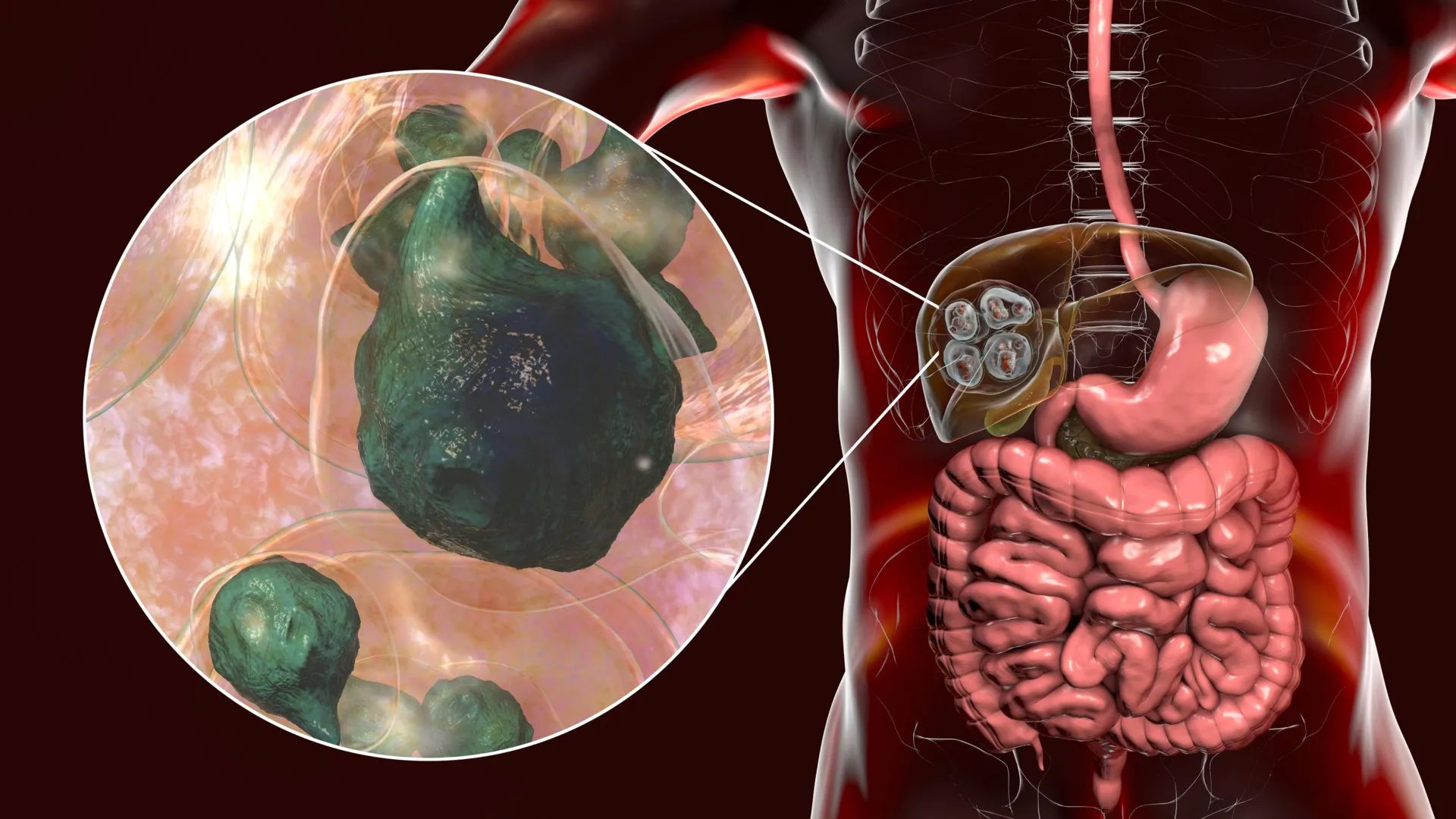 Deadly Tapeworm Reaches Pacific Northwest