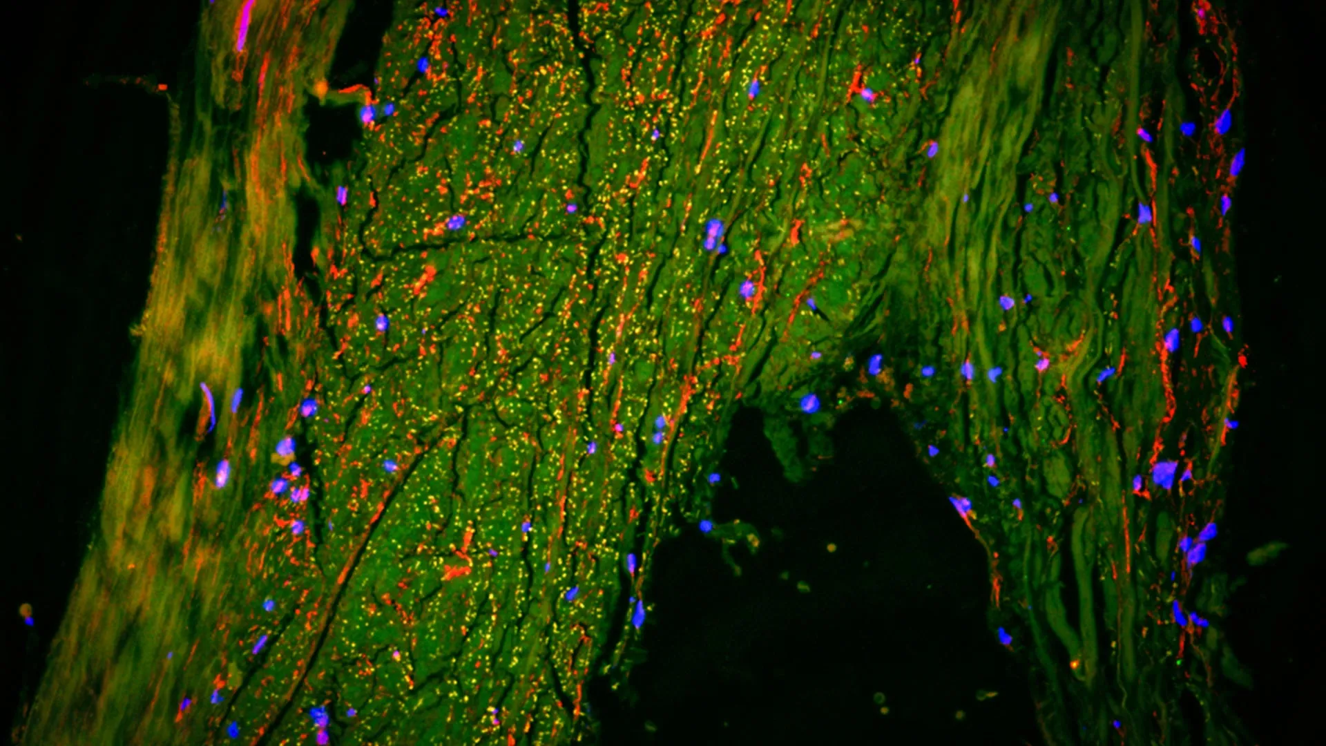 Hidden Brain Drainage System Found