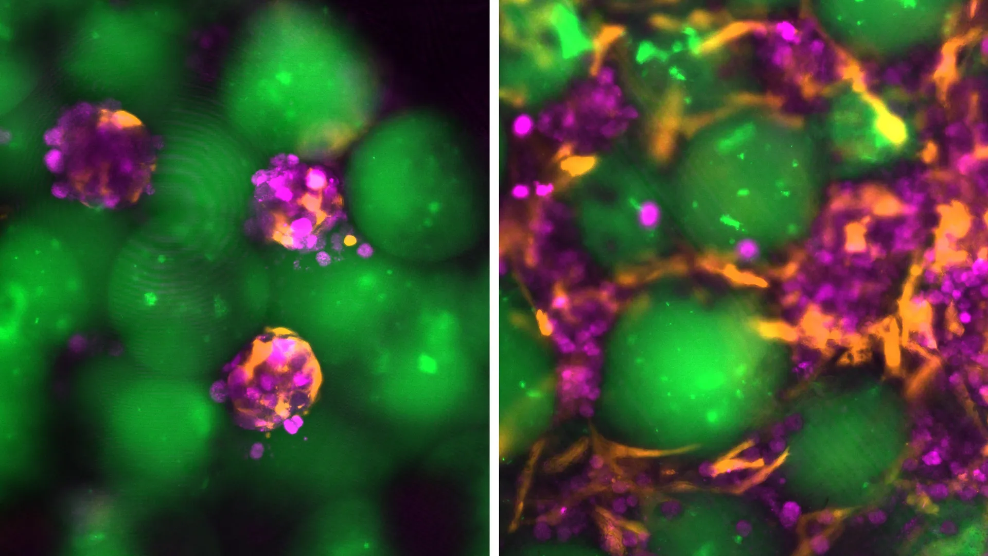 MIT Creates Injectable Mini Livers