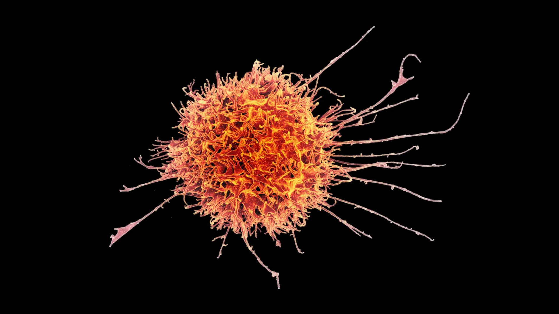 Supercharged Cells Attack Solid Tumors