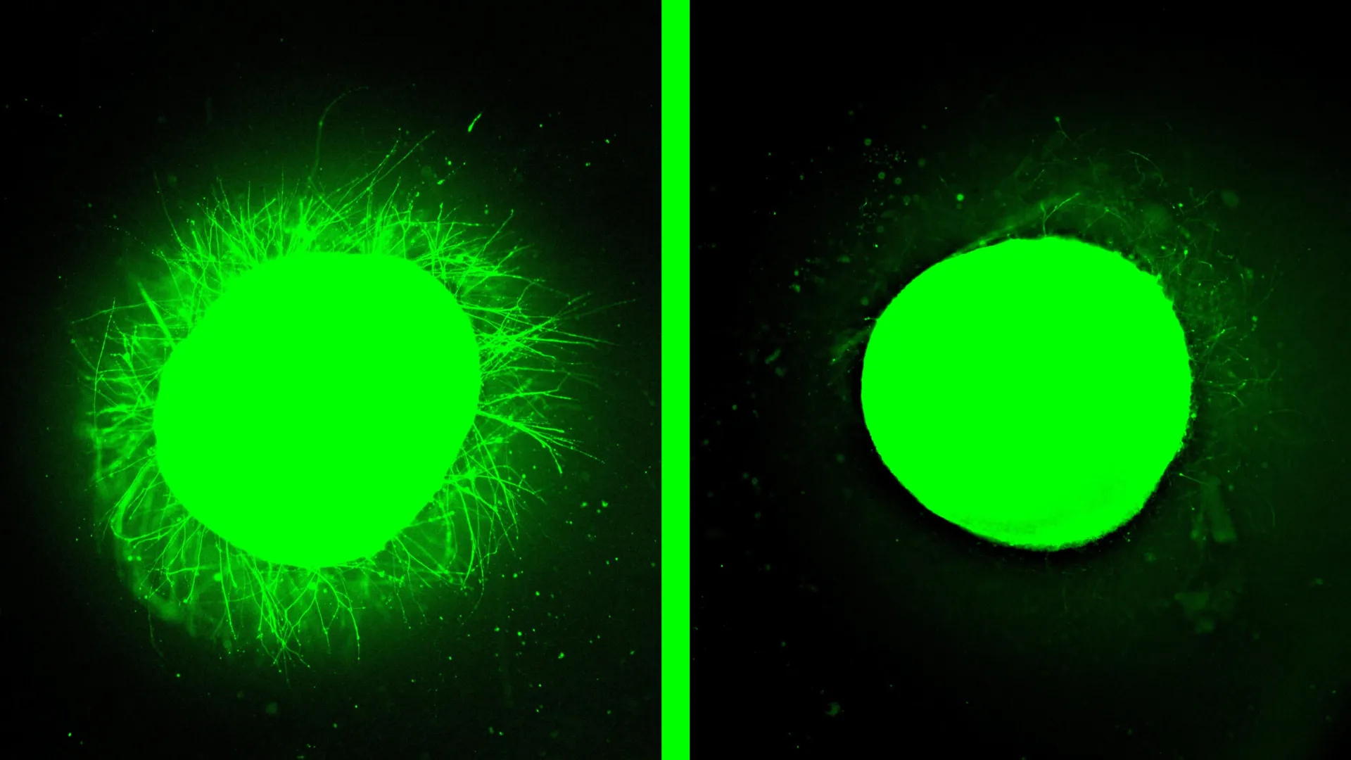 Lab Grown Human Spinal Cord Heals After Injury