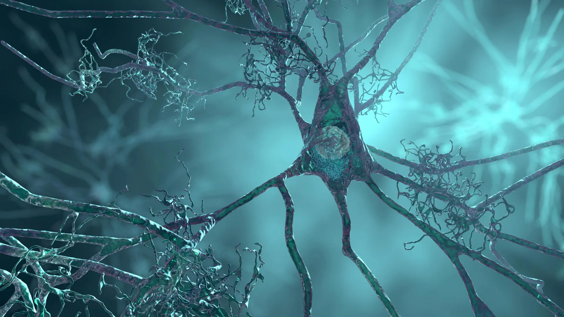 Alzheimer’s Gene May Shrink Neurons