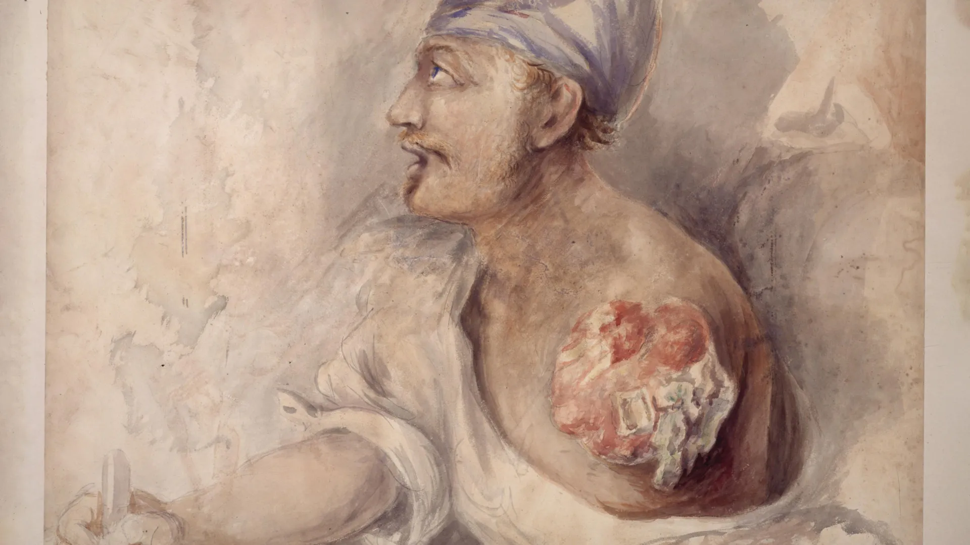 The Soldier Who Buried His Own Arm
