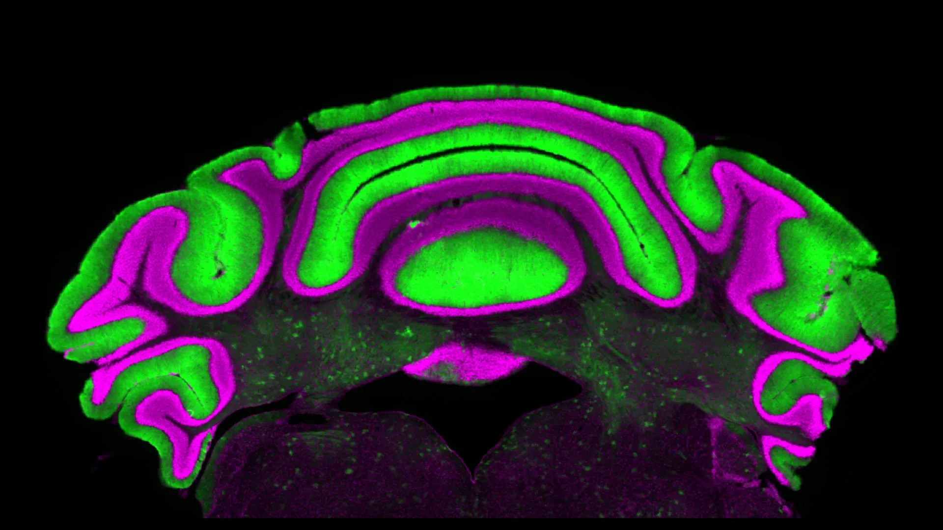 A Major Surprise Deep in the Brain