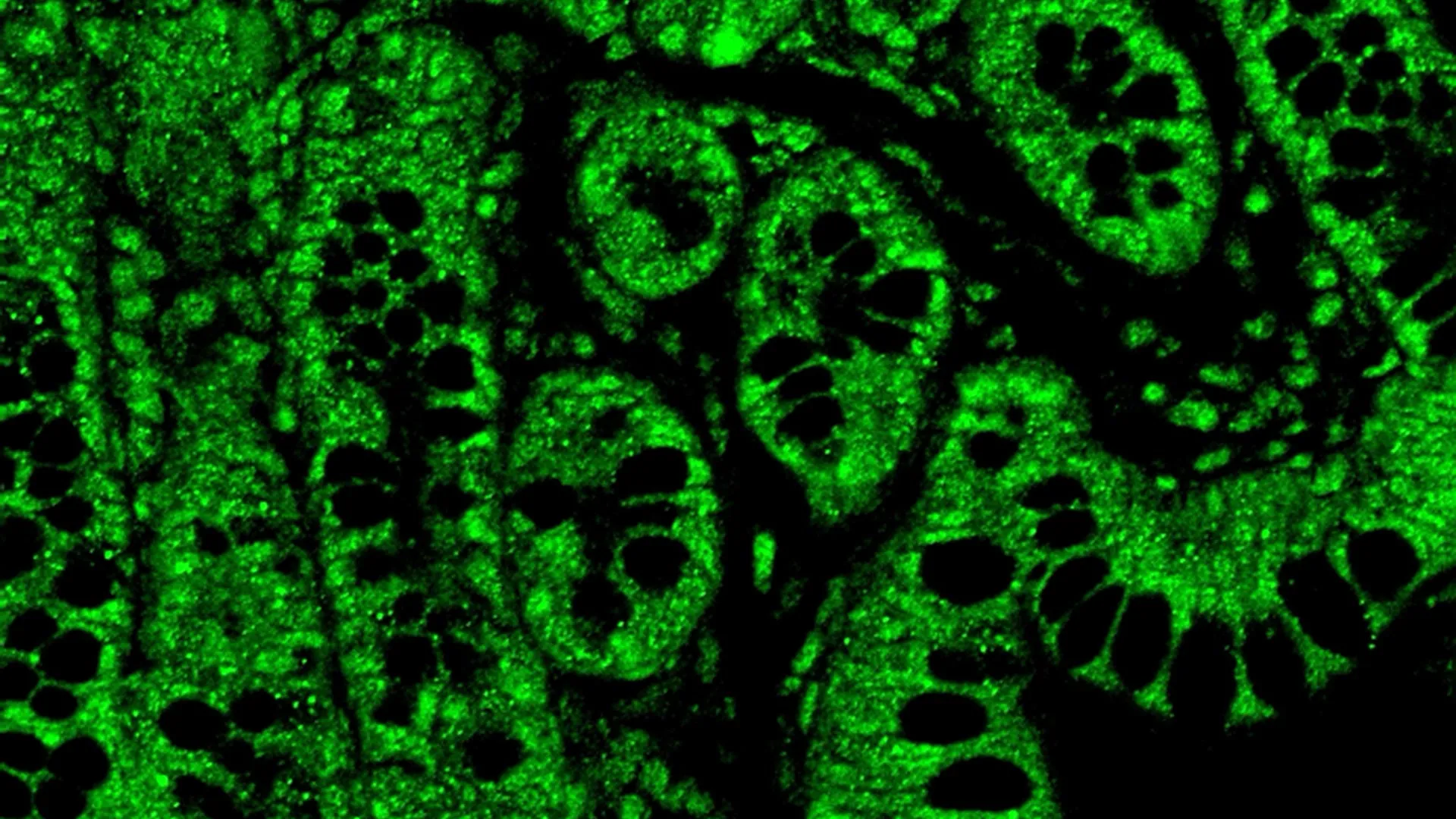 Tiny THC Doses Show Big HIV Benefits