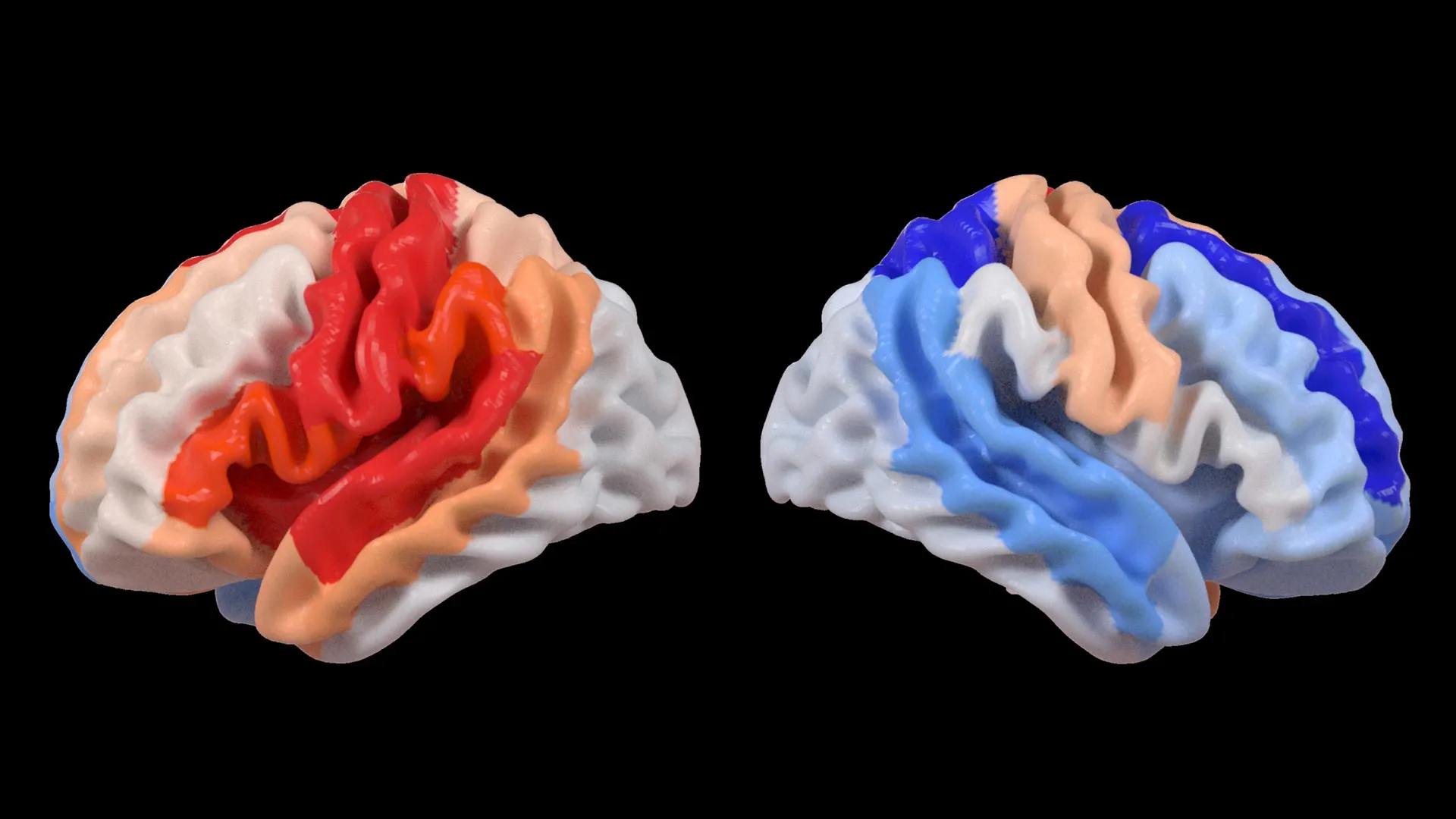 Stroke May Rejuvenate the Brain