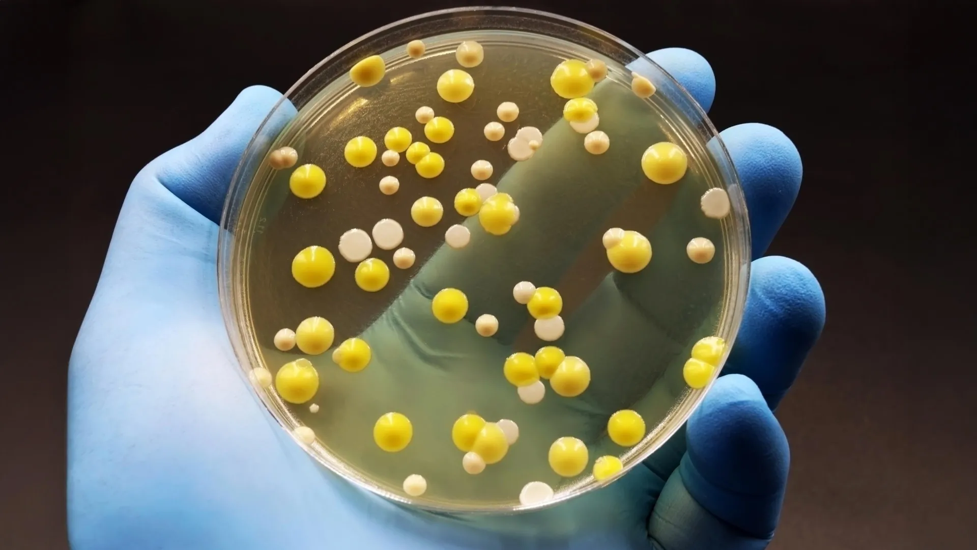 Graphene Kills Bacteria, Not Human Cells