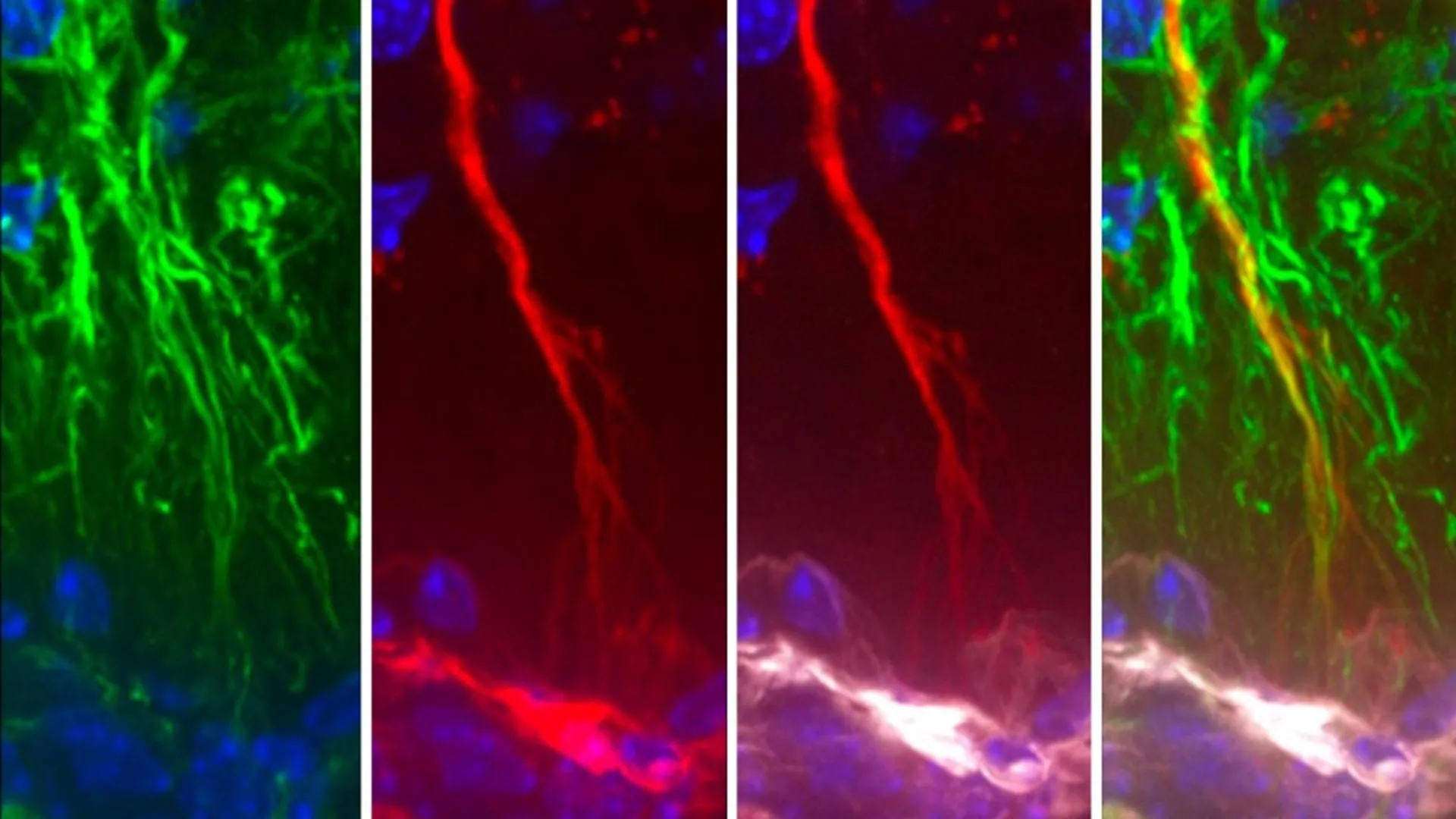 Hidden Brain Cells Linked to Alzheimer’s Tau