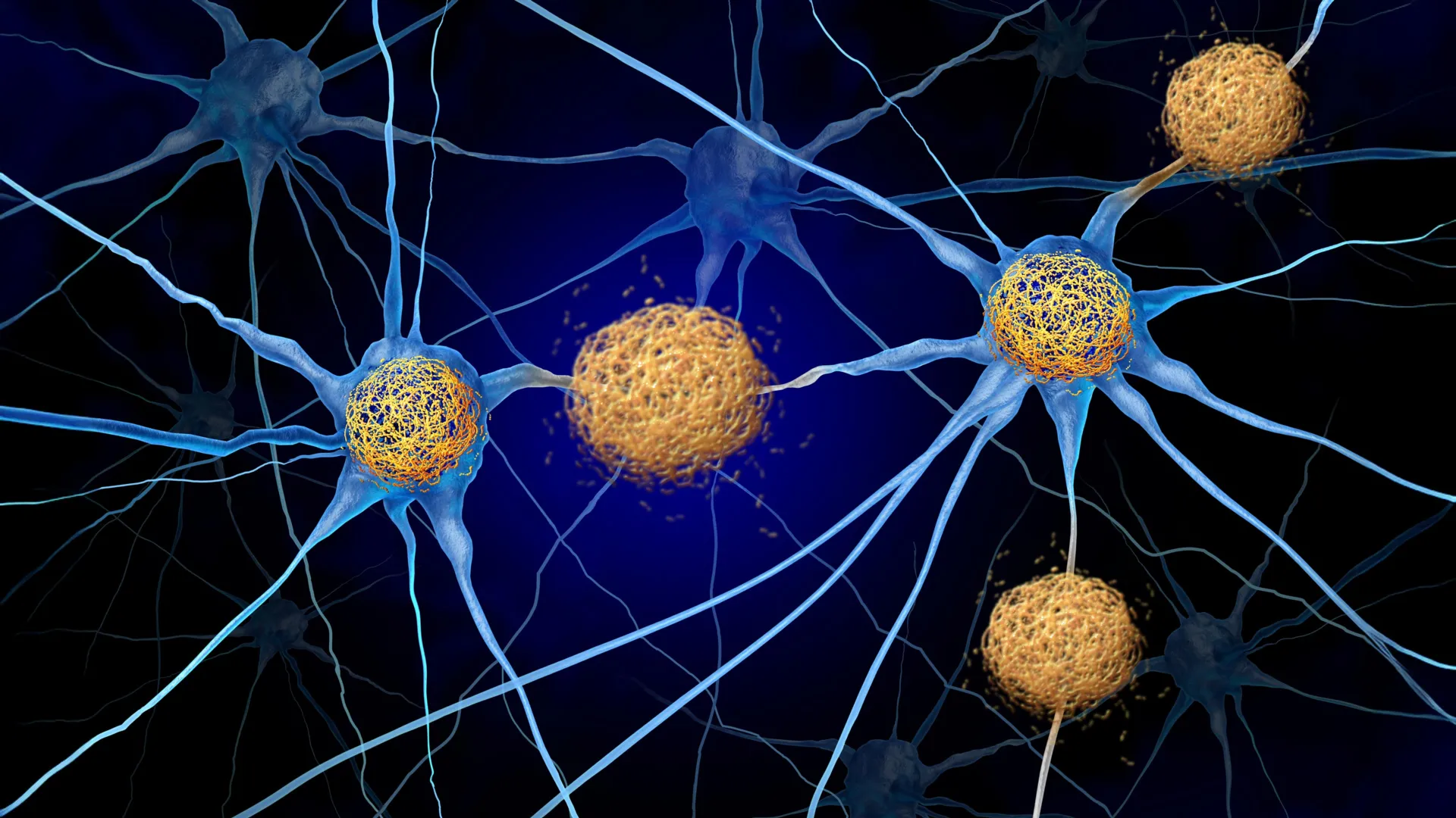 Hidden Alzheimer’s Signs Appear Early