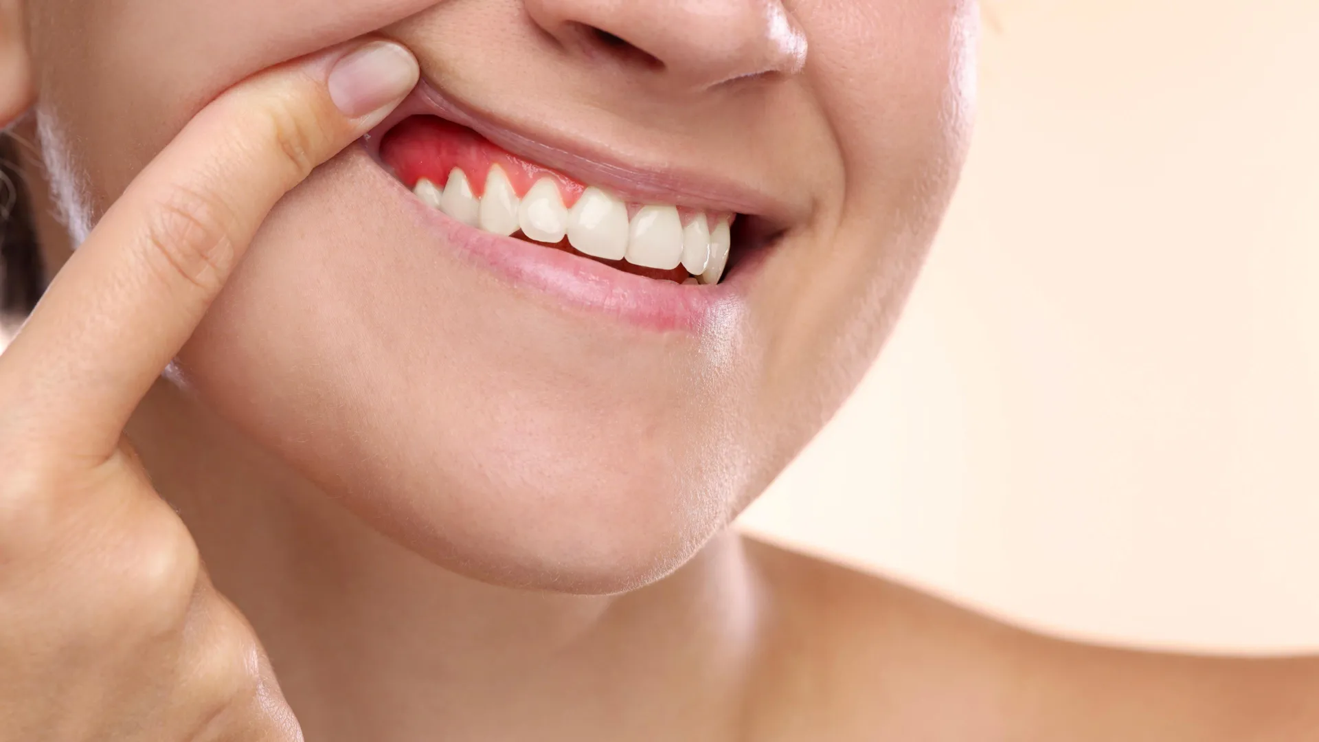 Fasting May Help Fight Gum Disease