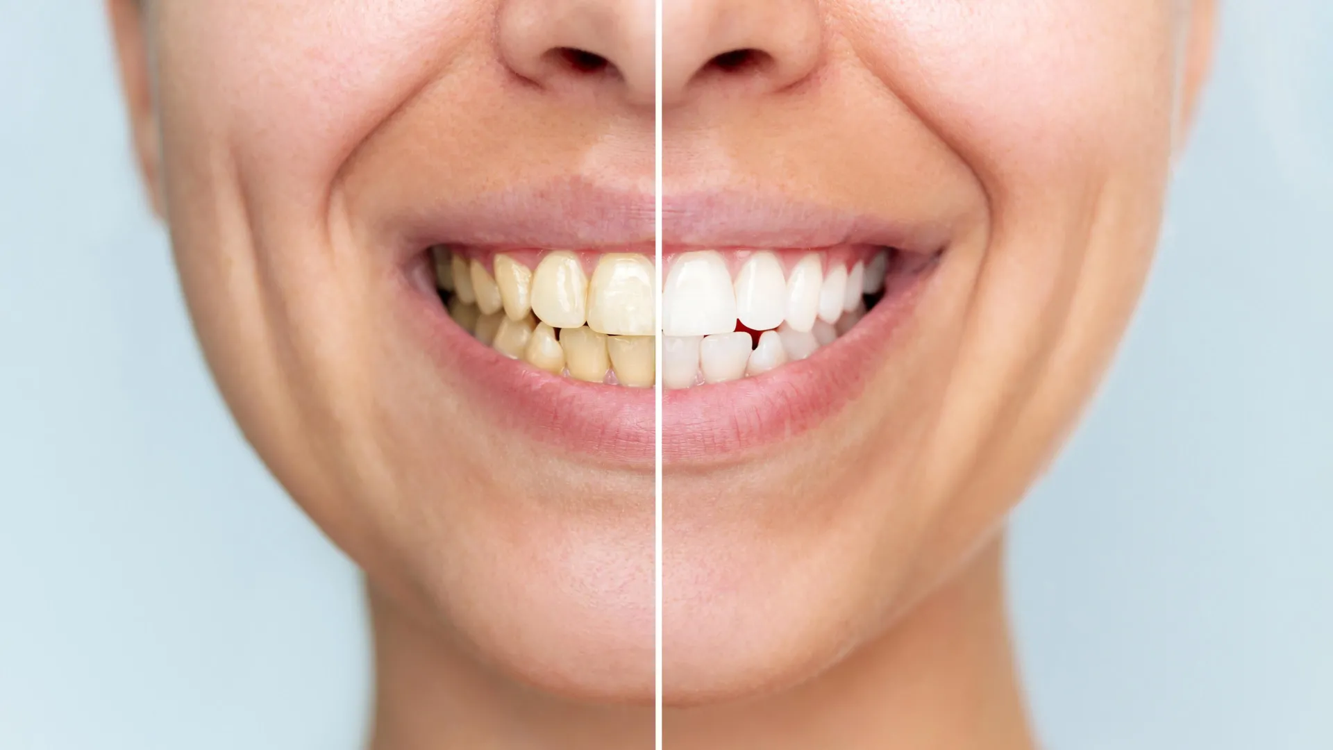 New Powder Whitens Teeth Without Damage